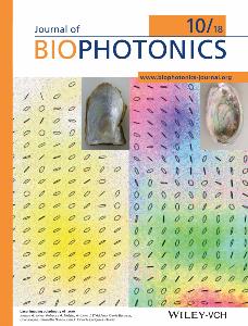 Journal of BioPhotonics cover